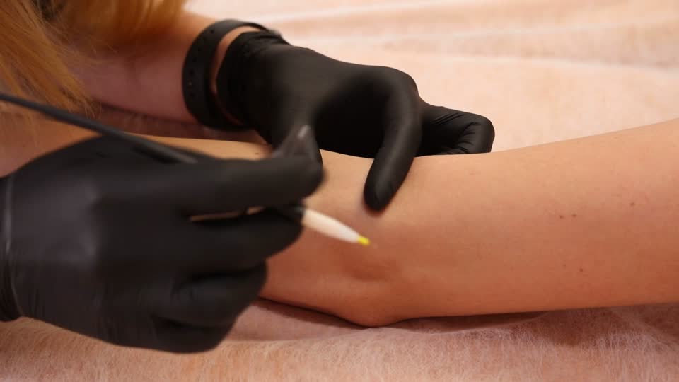 electrolysis